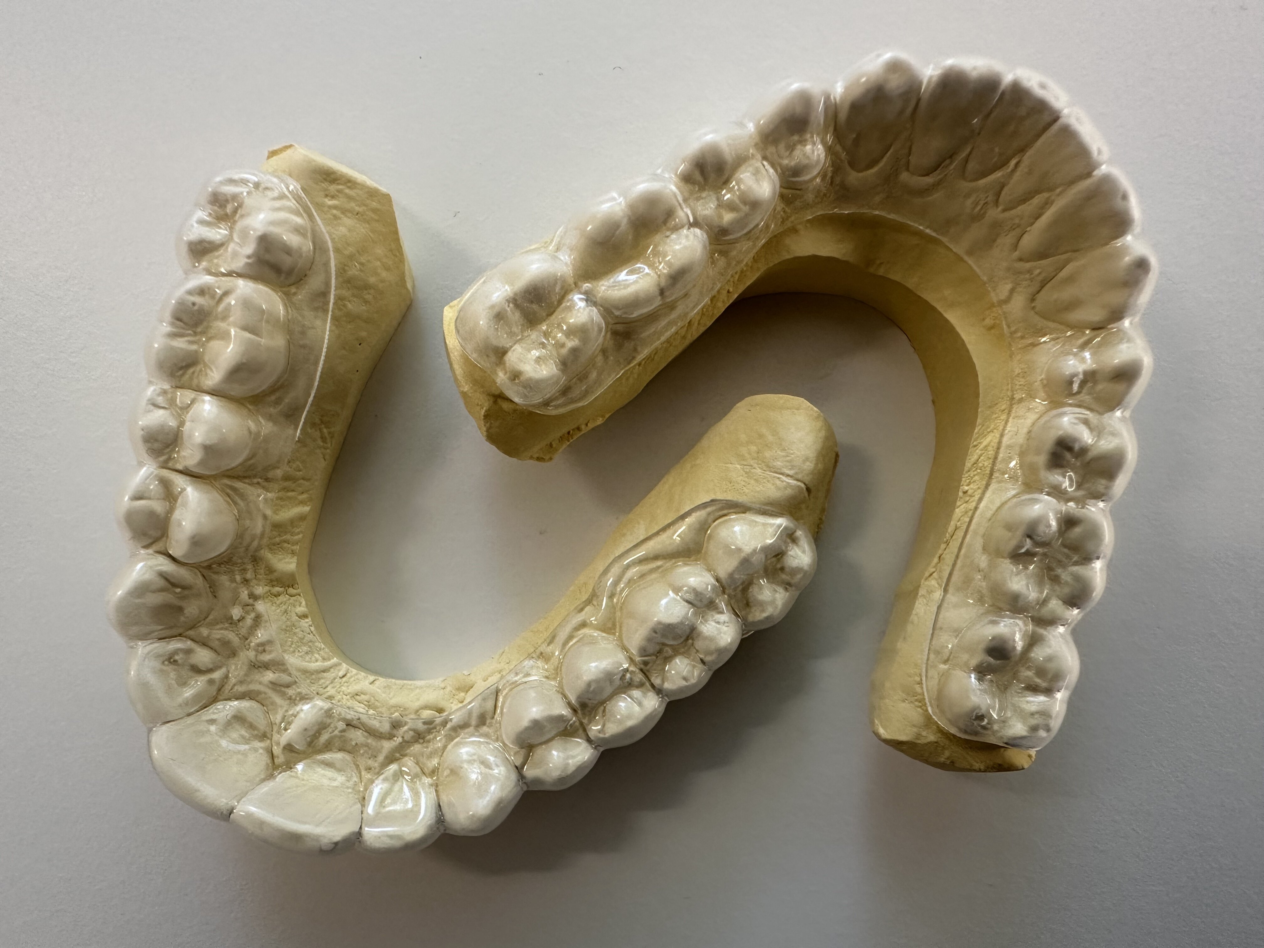 Smile design mock-up