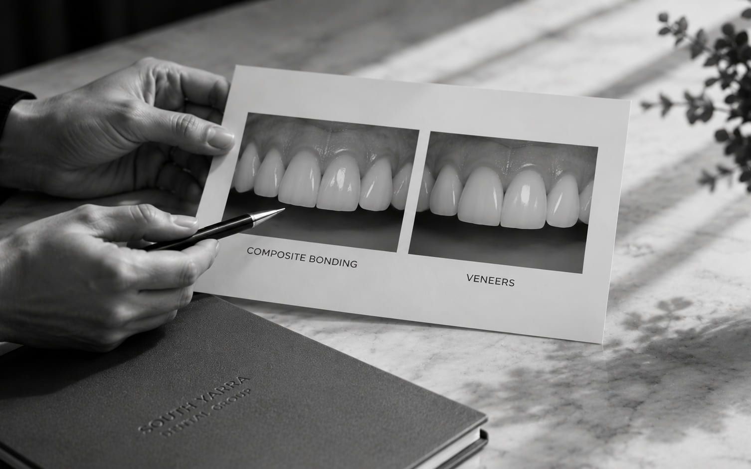 Hands holding a printed card comparing composite bonding with porcelain veneers