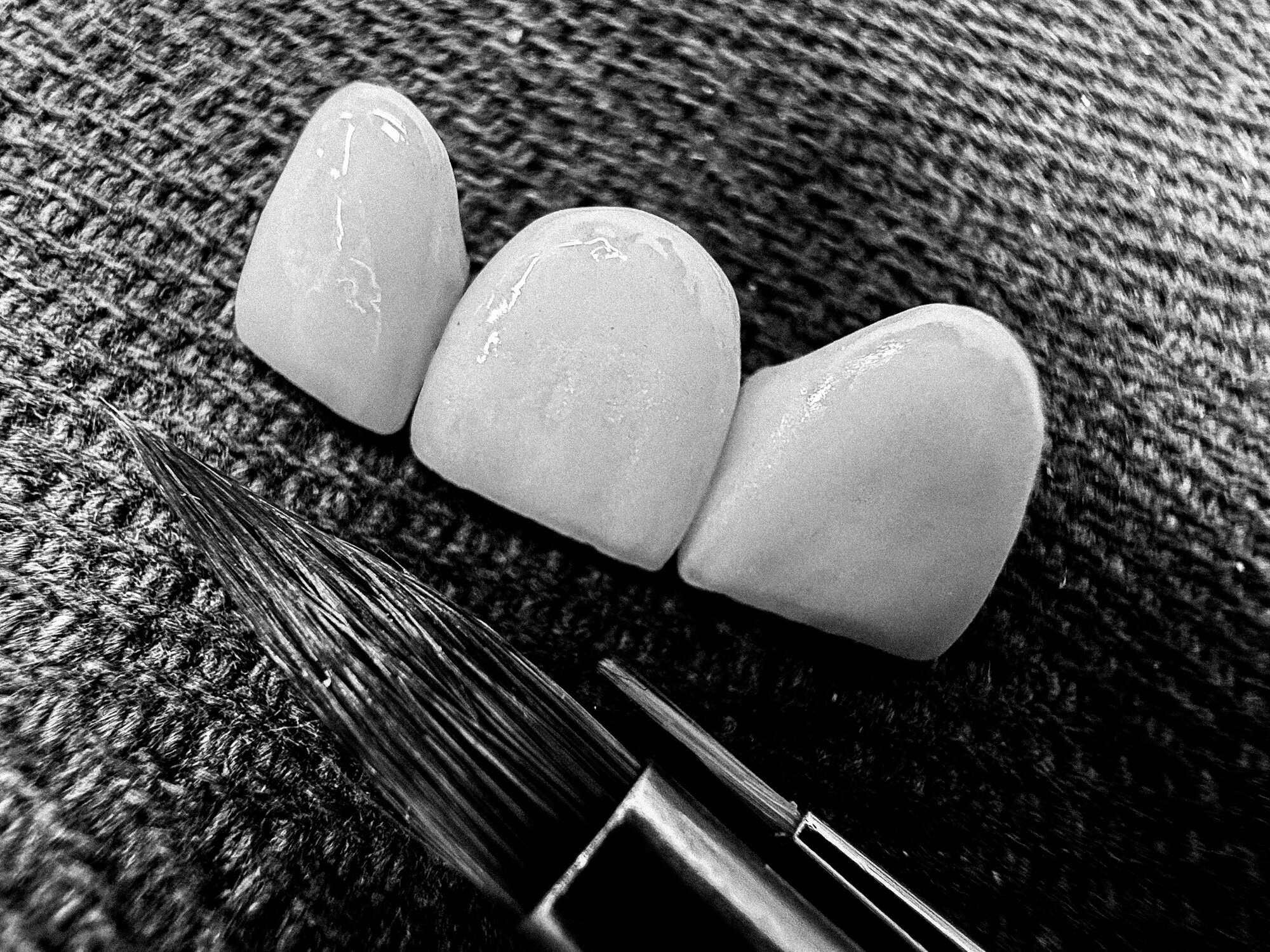 Detailed view of the finished veneers