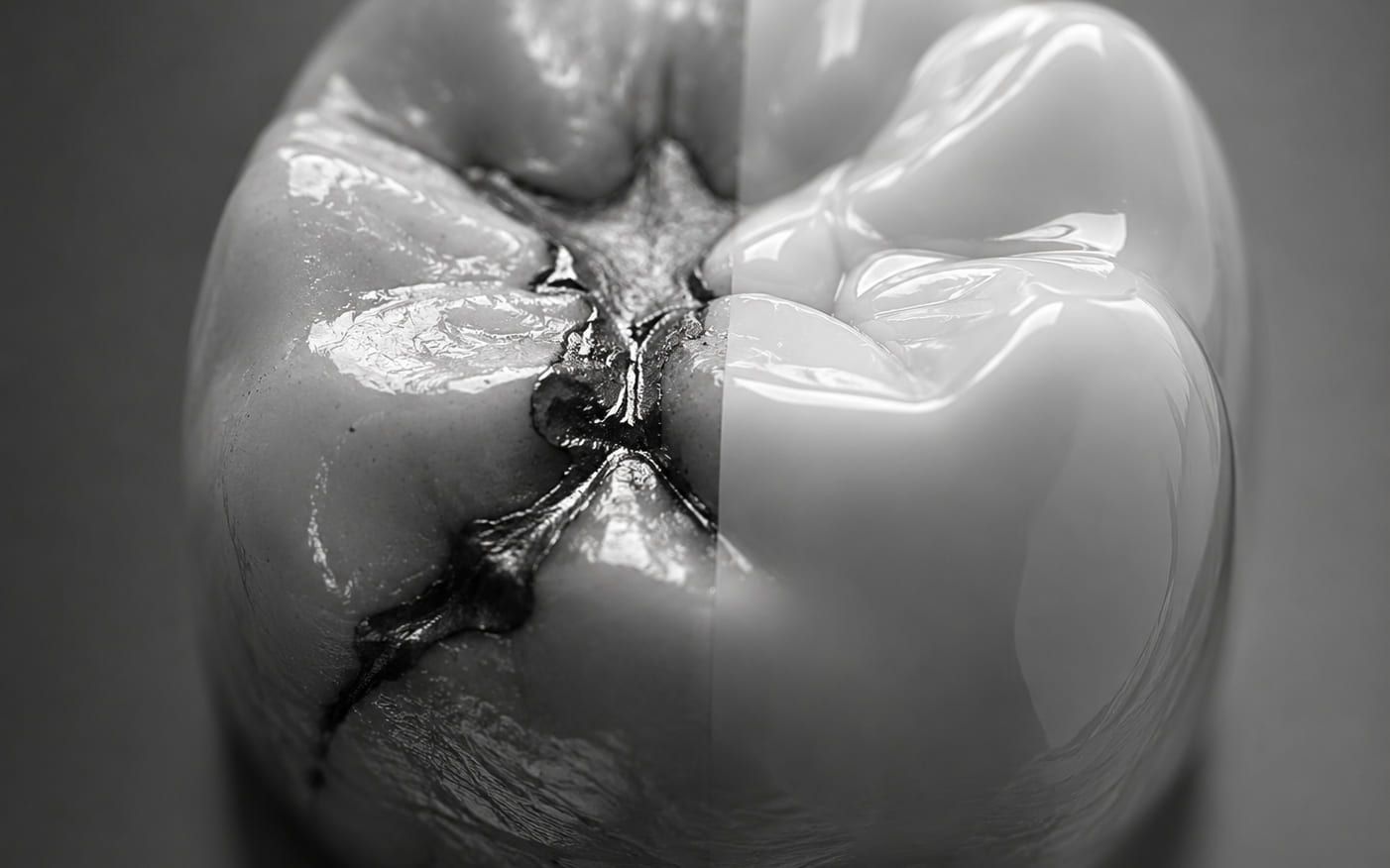 A single tooth shown split down the middle: heavily filled on one side, restored on the other