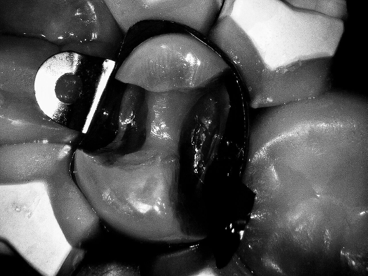 Detailed dental treatment documentation