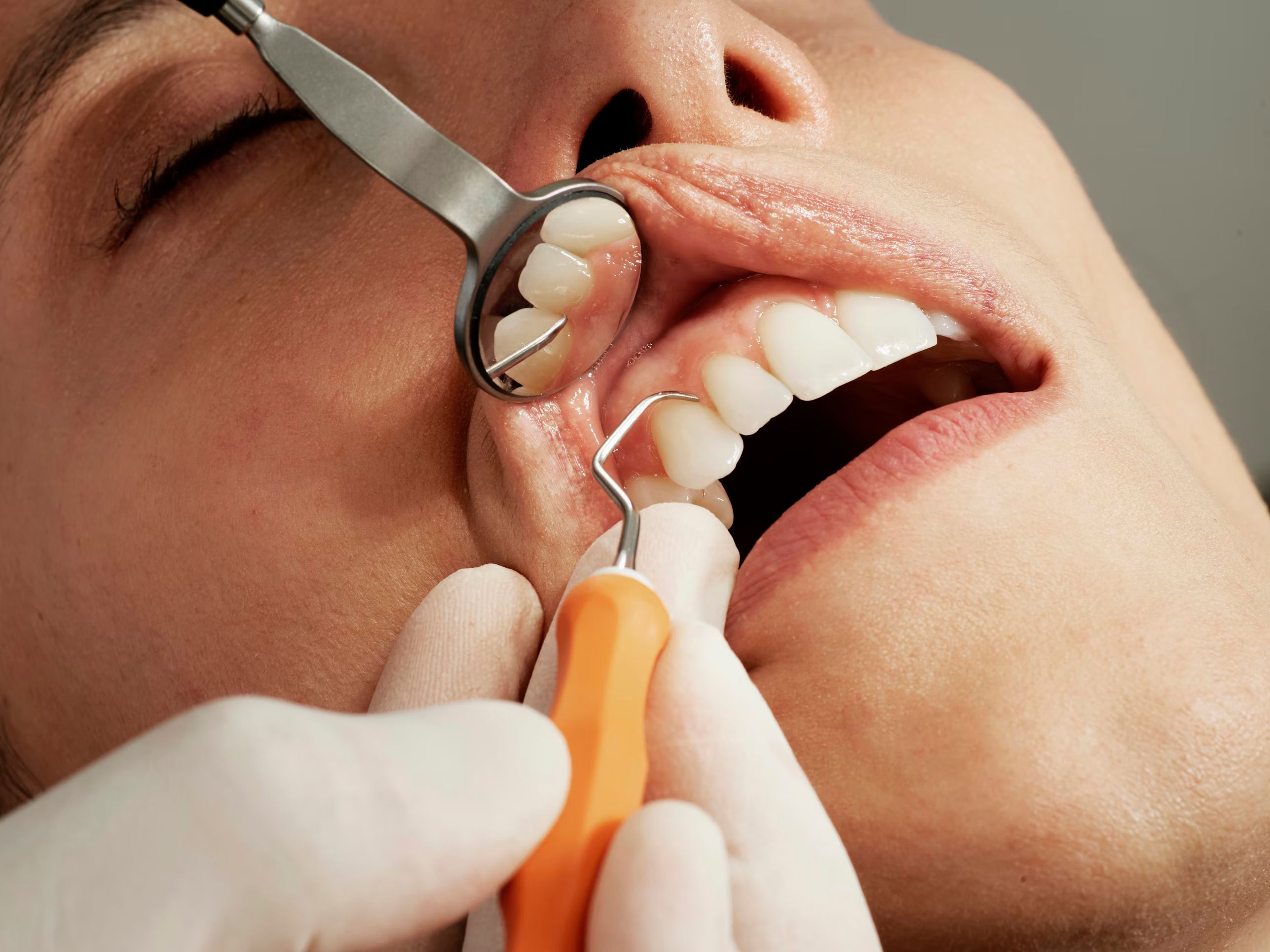 The Importance of Regular Dental Check-Ups for Preventing Major Issues
