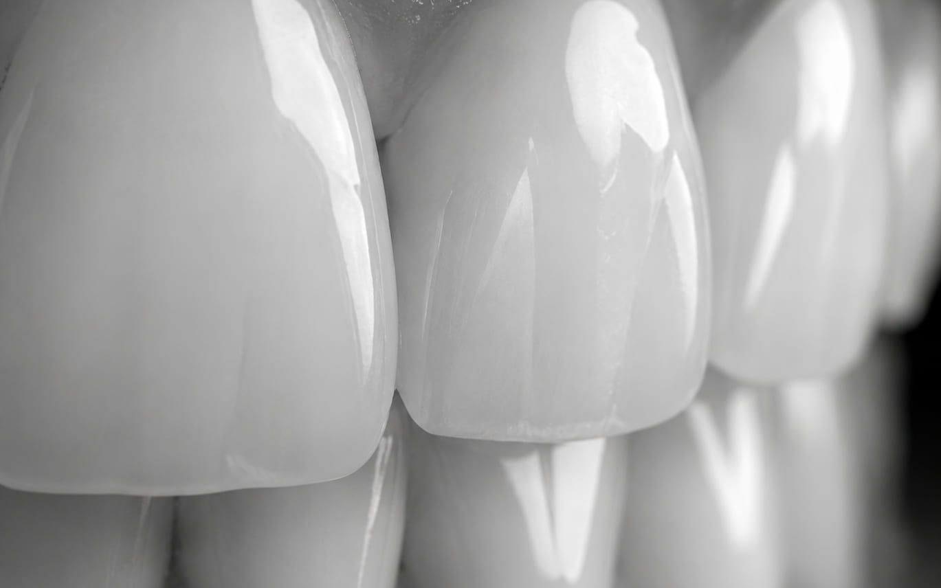 Extreme close-up of healthy, evenly shaded front teeth