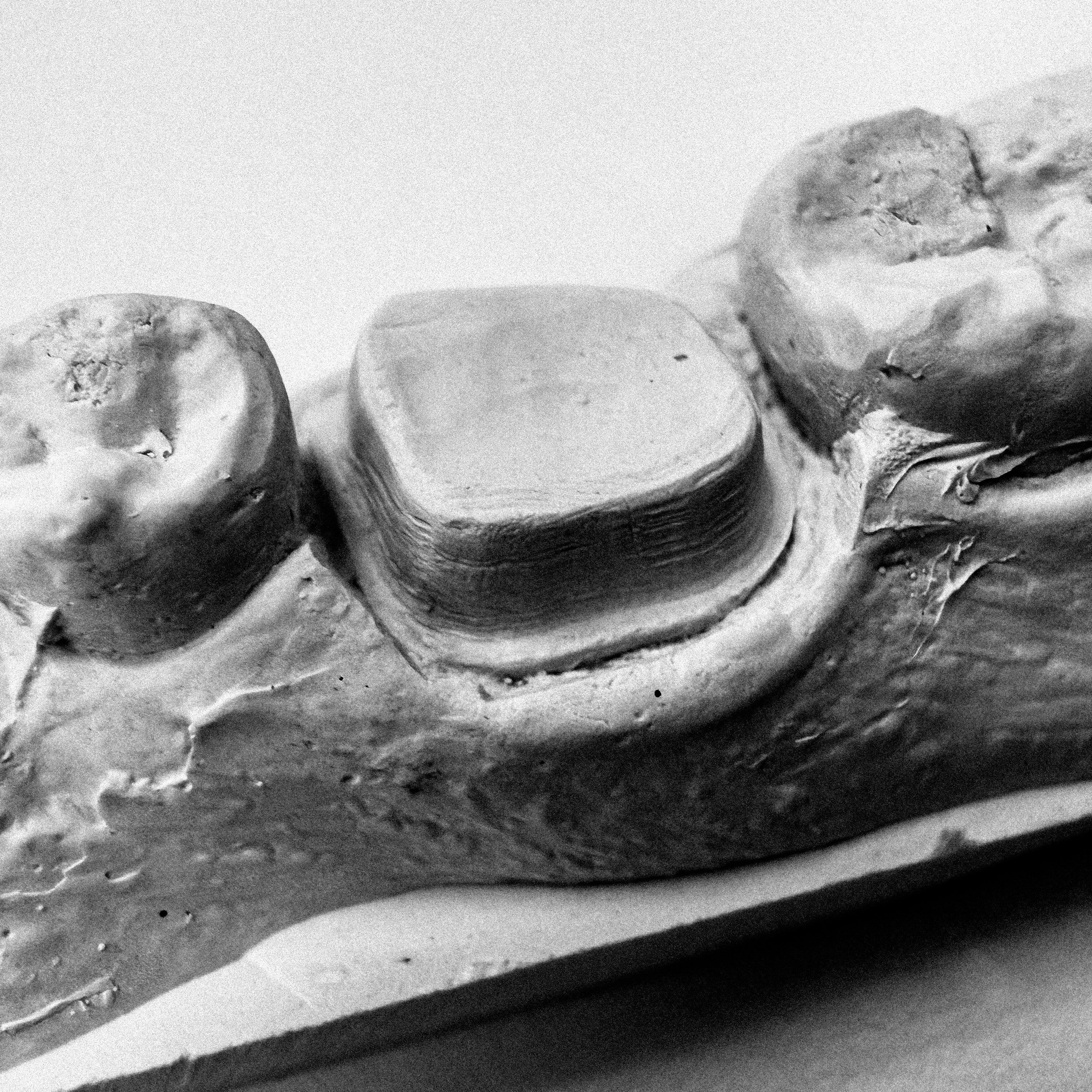 High-power dental magnification equipment