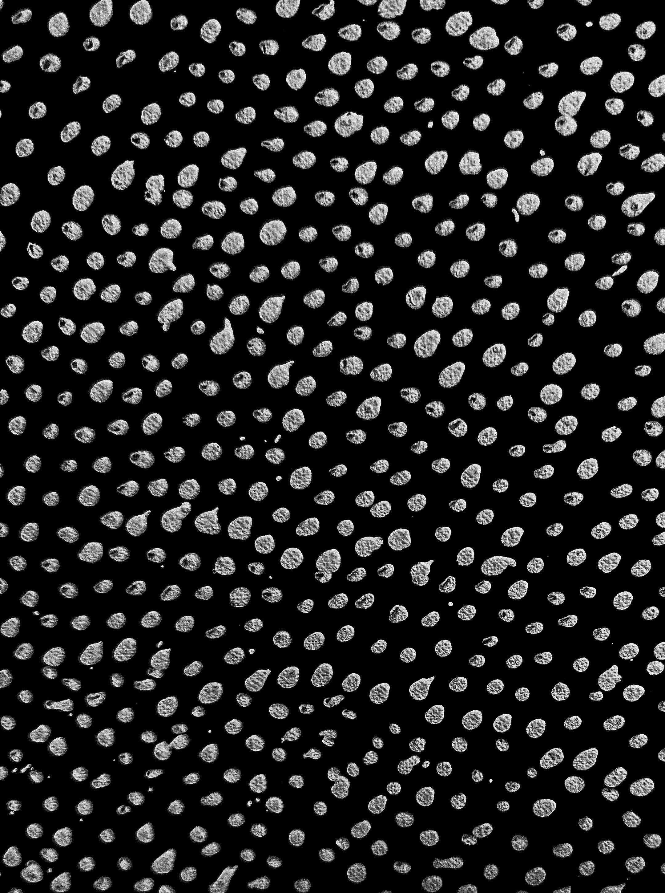 Root canal therapy at South Yarra Dental Group