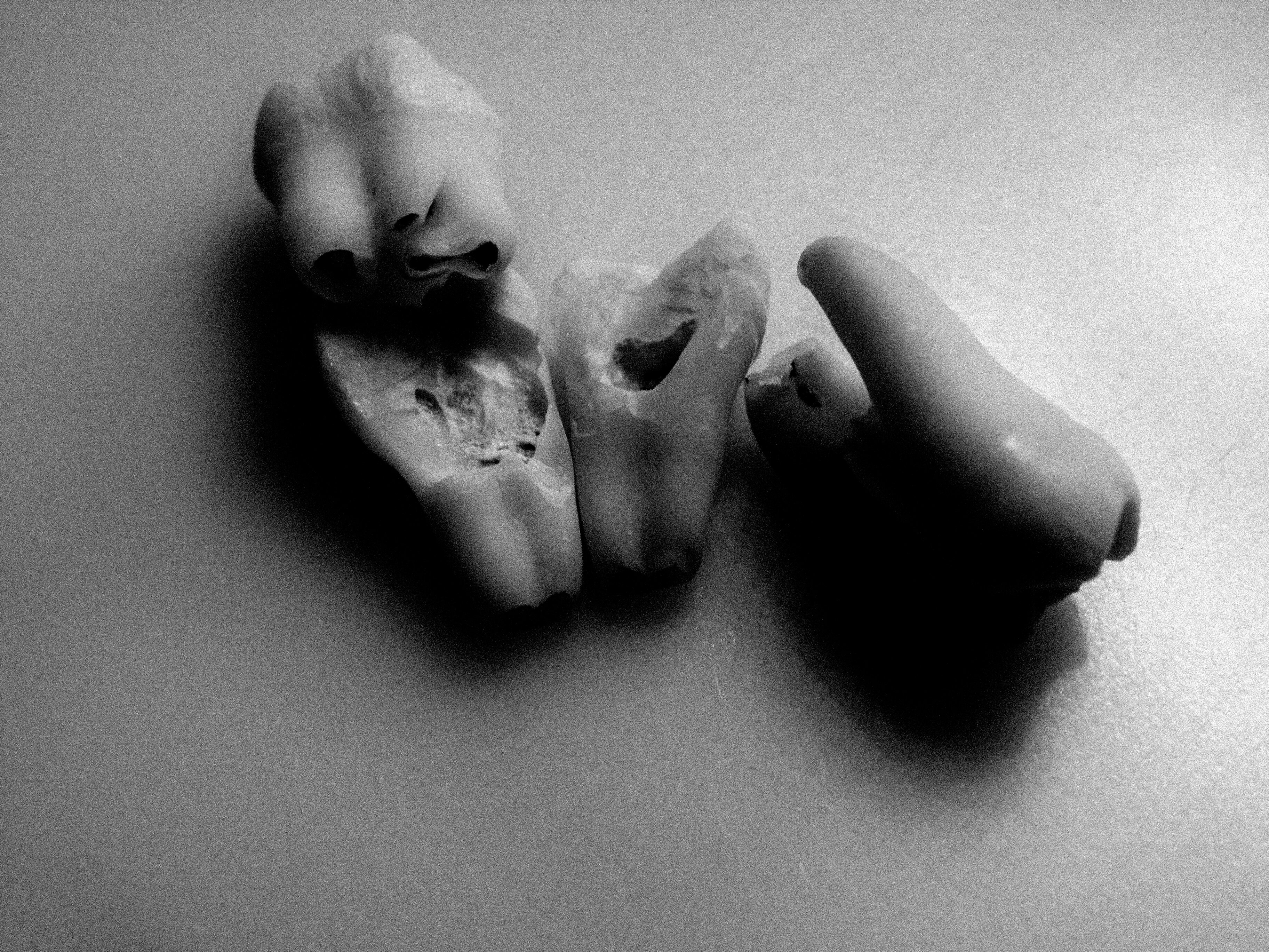 What Were Wisdom Teeth Originally Used For